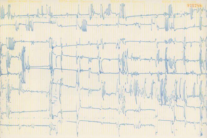 Lars Fredrikson, Partitur A (detalj), 1971. Courtesy Lars Fredrikson Estate & Galerie In Situ – fabienne leclerc, Paris